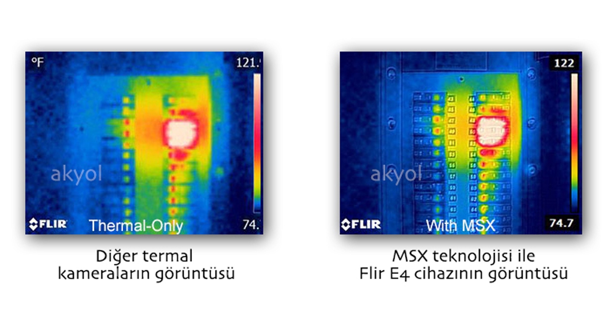 MSX® nedir?